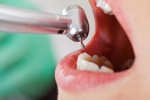 Best Emergency Dentist for Knocked-Out Tooth in Durant, MS